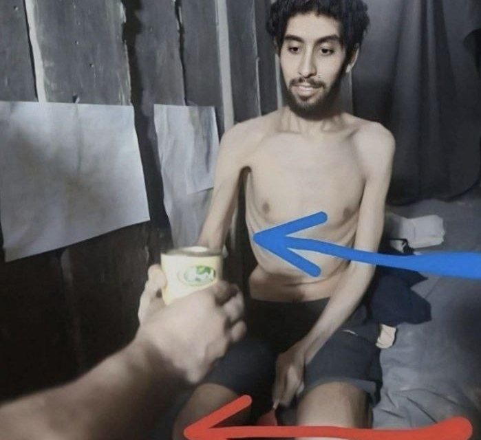 هل يجوز تجويع الأسير في الإسلام؟